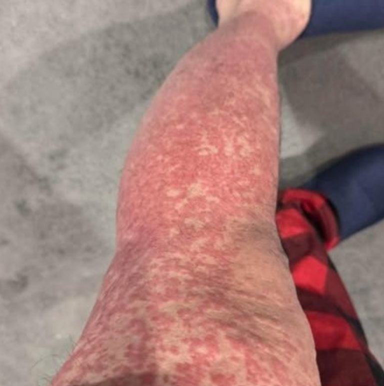 These are the consequences of sleeping with…